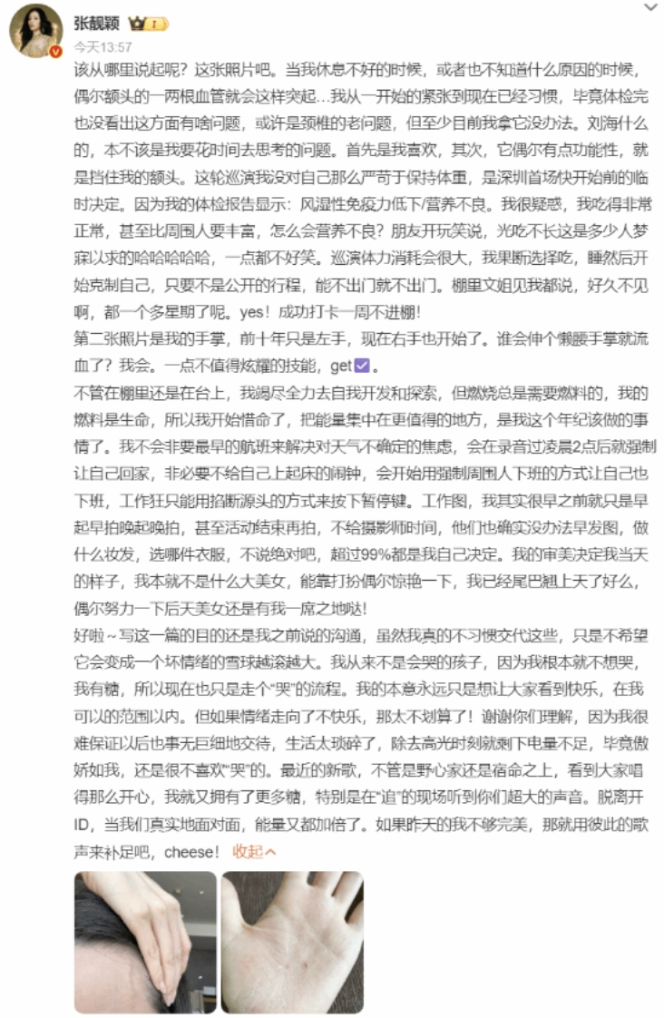 张靓颖一伸懒腰手掌就流血怎么回事 张靓颖一伸懒腰手掌就流血详情介绍 - 乐哥常识网
